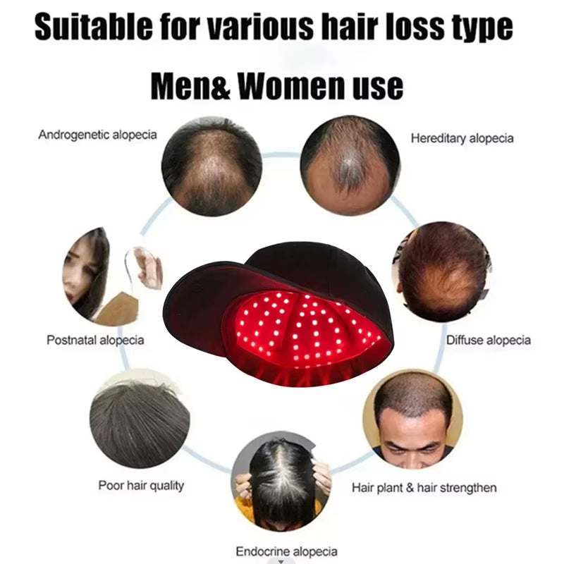 660Nm 850Nm Red Light Infrared Hair Therapy Hair Growth Cap for Hair Regrowth anti Hair Loss Relax Scalp Care Hat anti Hair 2024