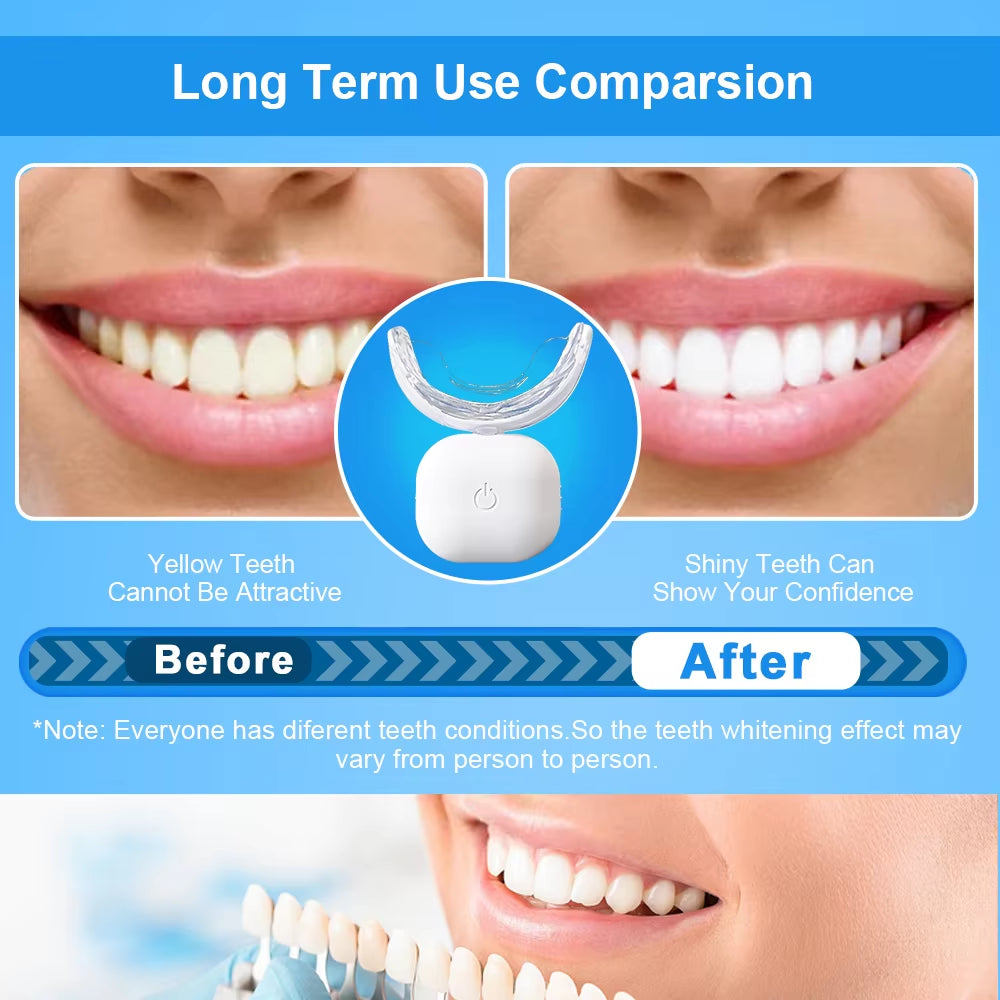 Whiten Tooth Home Use Mini Blue and Red 32 LED Lights Rechargeable Tooth Whitening LED Wireless Teeth Whitening Lamp