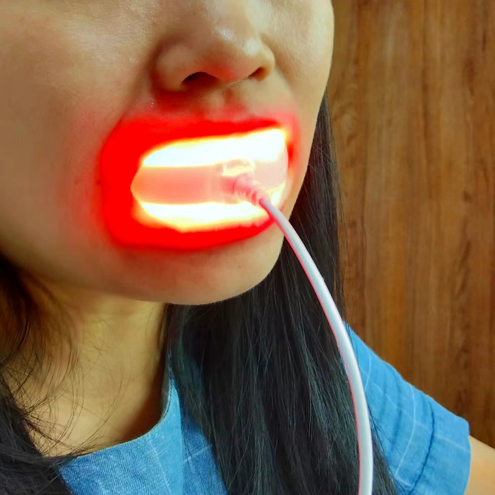 AutoDS Spare: Dental Red Light Therapy Instrument Teeth Pain Cold Sore Canker Treatment Infrared Light for Mouth Oral Physiotherapy Tool